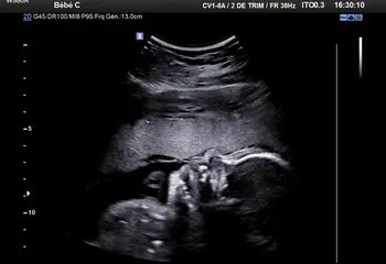 Image d'illustration pour À l'occasion de la naissance de notre Adrien, donnons un coup de pouce aux enfants du monde !